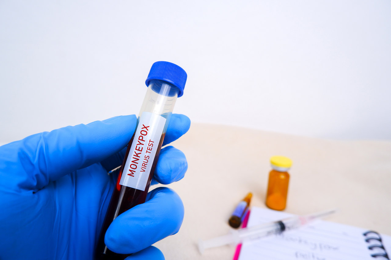 Agência Ideia Goiás - Fiocruz solicita registro de dois kits moleculares para varíola dos macacos